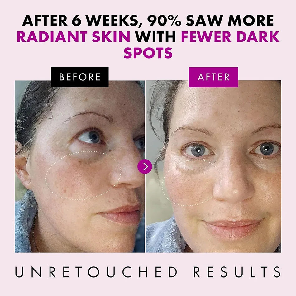 Crème Visage au Collagène 50g - Hydratant Jour/Nuit