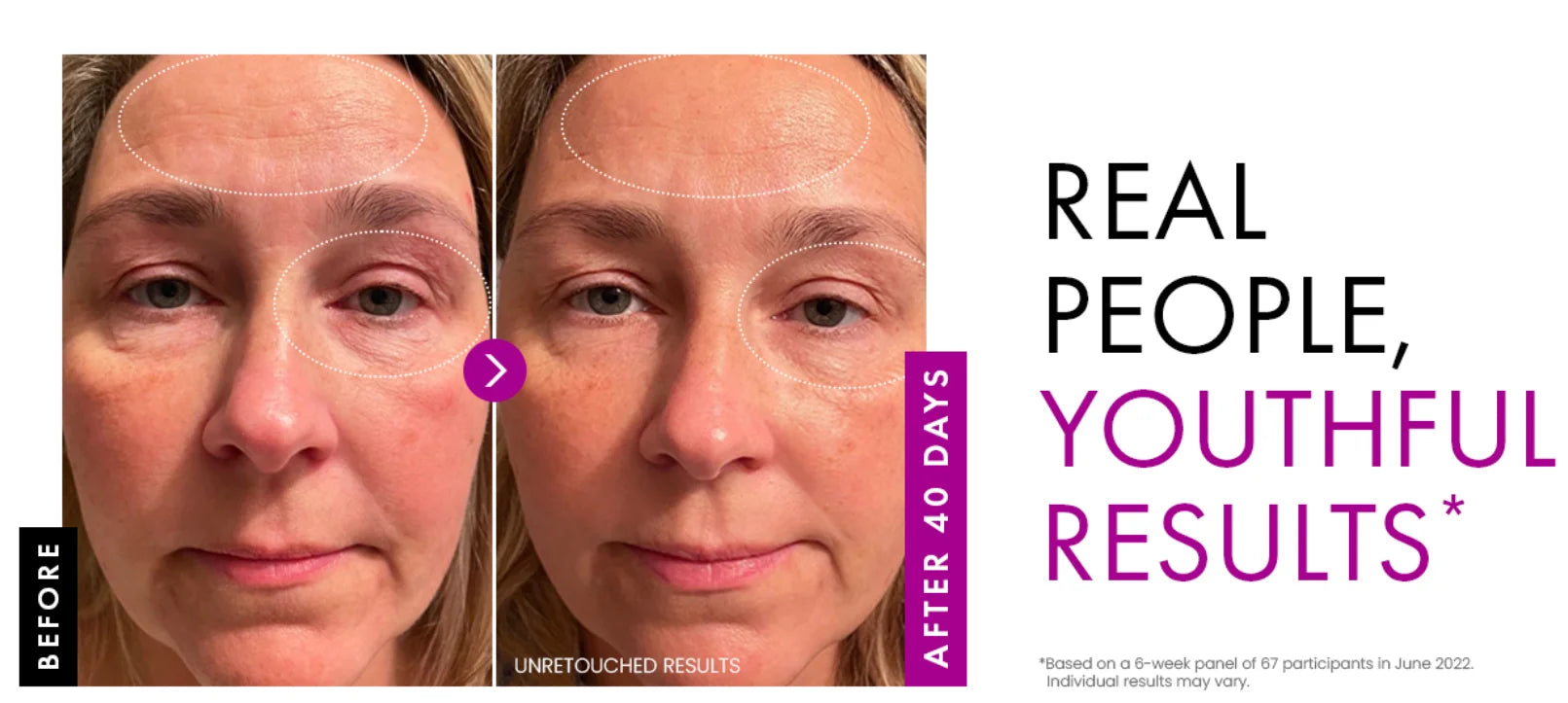 Crème Visage au Collagène 50g - Hydratant Jour/Nuit